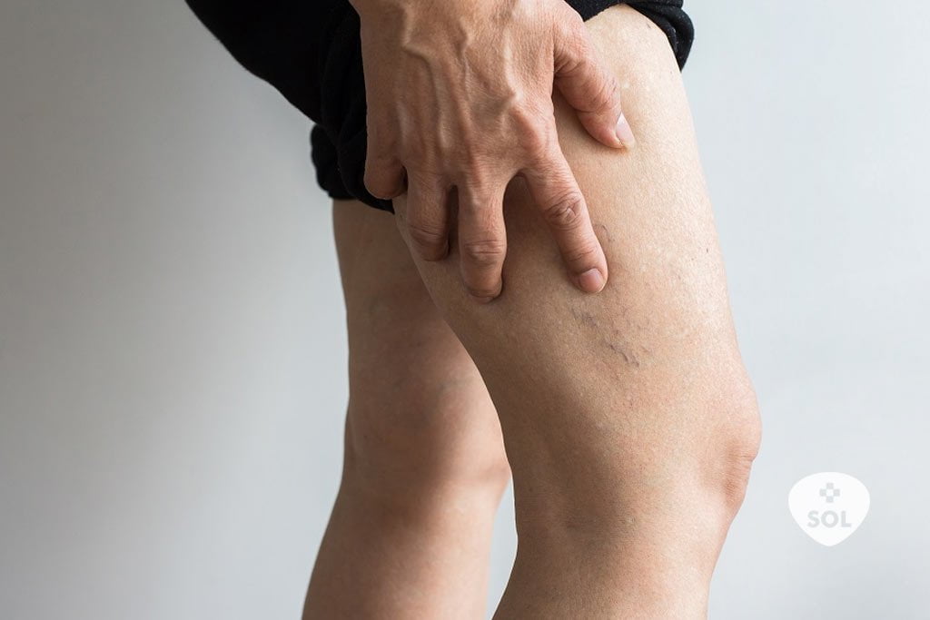 Trombose: uma doença mais comum do que se imagina