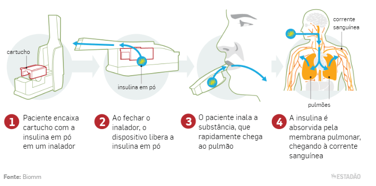 Como funciona a insulina inalável?