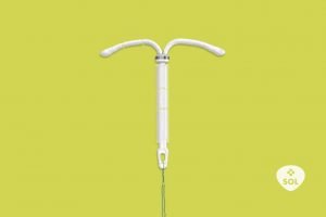 DIU Kyleena: uma nova opção de contracepção hormonal