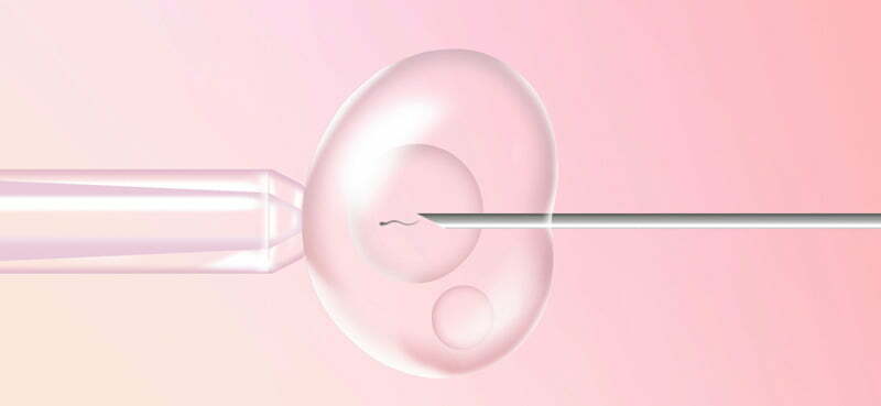 Medicamentos Protocolo Estimulação Ovariana