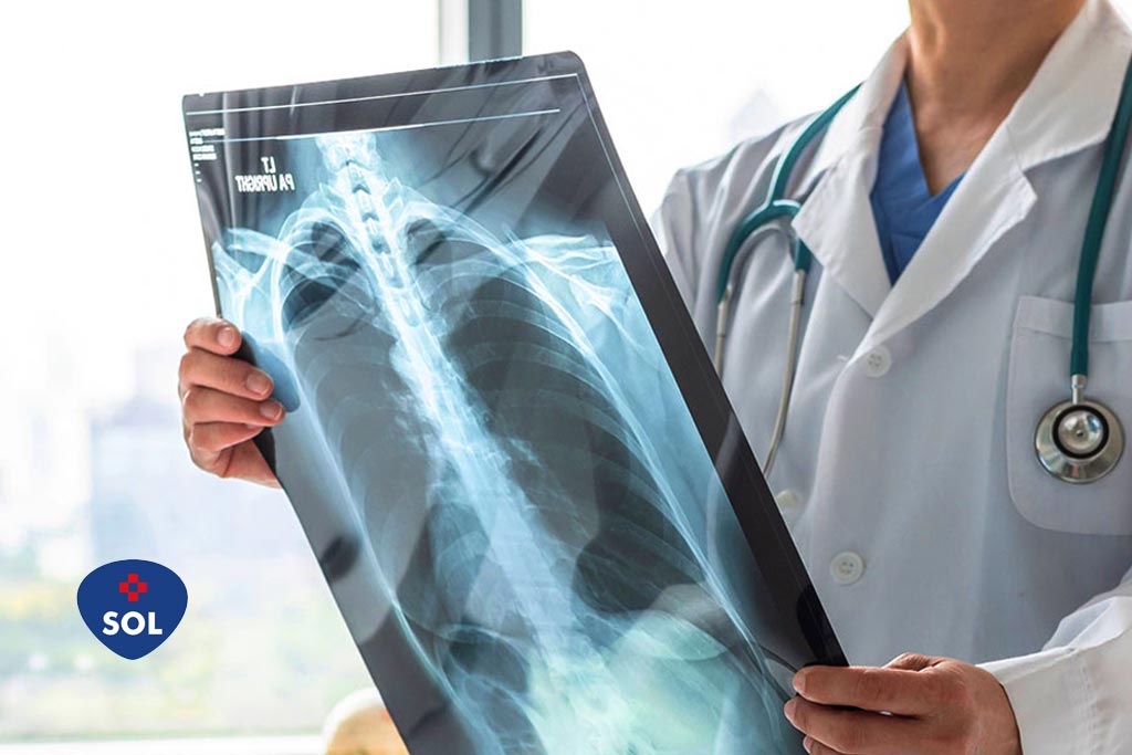 Gefitinibe no tratamento do câncer de pulmão de não-pequenas células (CPNPC)