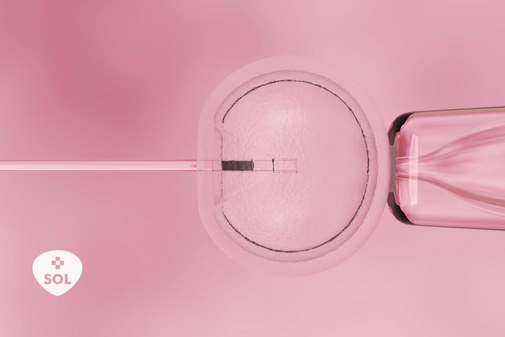 Medicamentos usados na FIV: saiba mais sobre o tratamento  