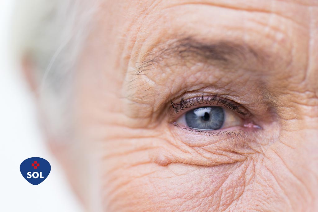 Eylia (Aflibercepte) no tratamento da degeneração macular (DMRI)