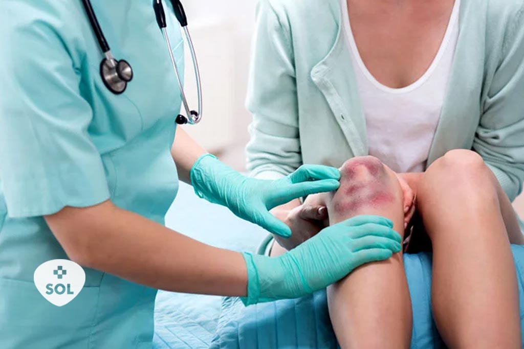 Púrpura Trombocitopênica Idiopática (PTI): causas e tratamento