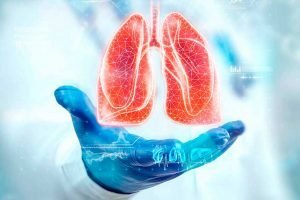 Osimertinibe: estudo confirma aumento da sobrevida para pacientes com câncer de pulmão