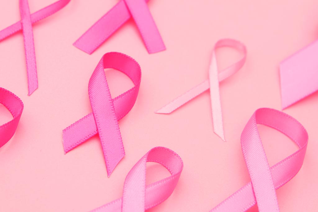 Fique atenta: 5 alterações nas mamas que podem indicar câncer