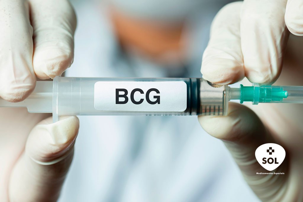 Urohipe BCG no tratamento do câncer de bexiga